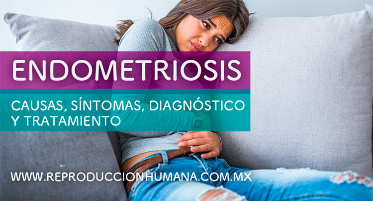 Síntomas, diagnóstico y tratamiento de la Endometriosis
